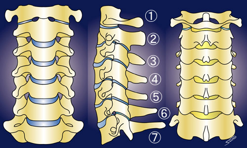 「頸椎椎体　５番６番」の画像検索結果